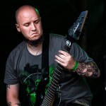 0042 Congenital Anomalies